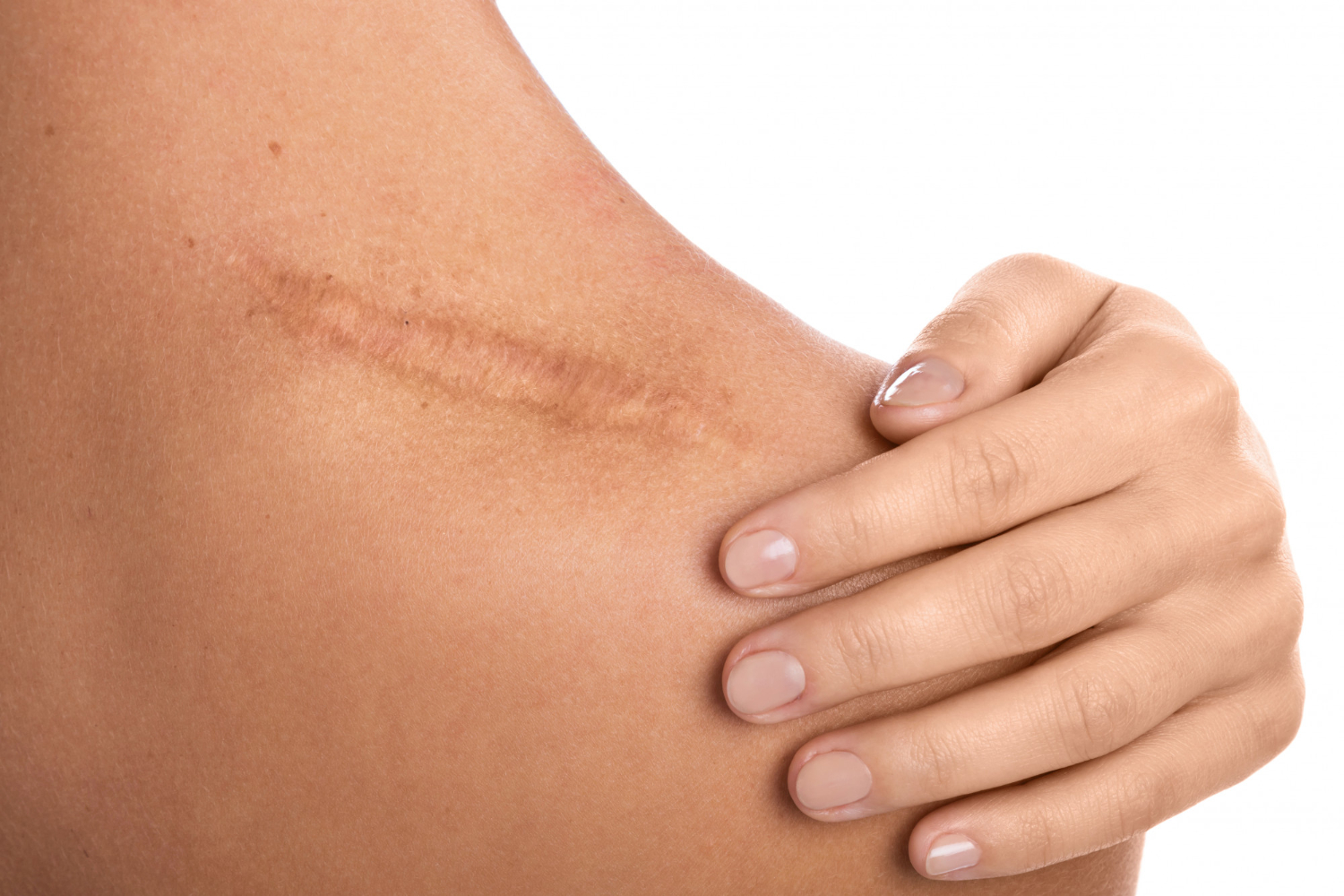 Post Surgical & Scar Tissue Massage